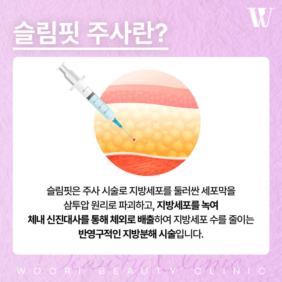 슬림핏주사 자연스러운 얼굴선 만들기 관련 이미지 2