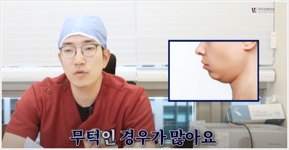 이중턱살제거 턱끝수술도 함께 해야해 관련 이미지 3