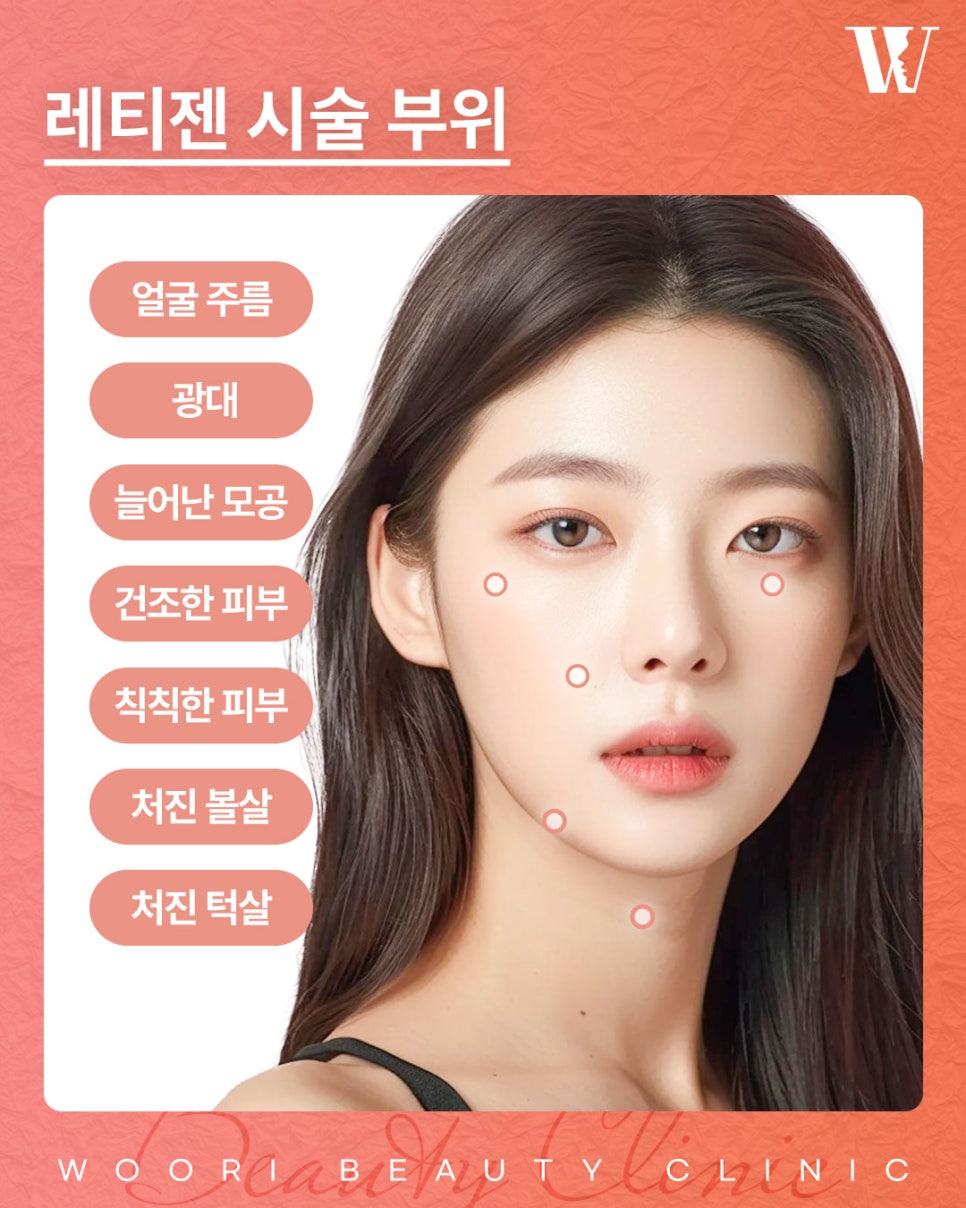 레티젠 스킨부스터 특징 알아보기 관련 이미지 4