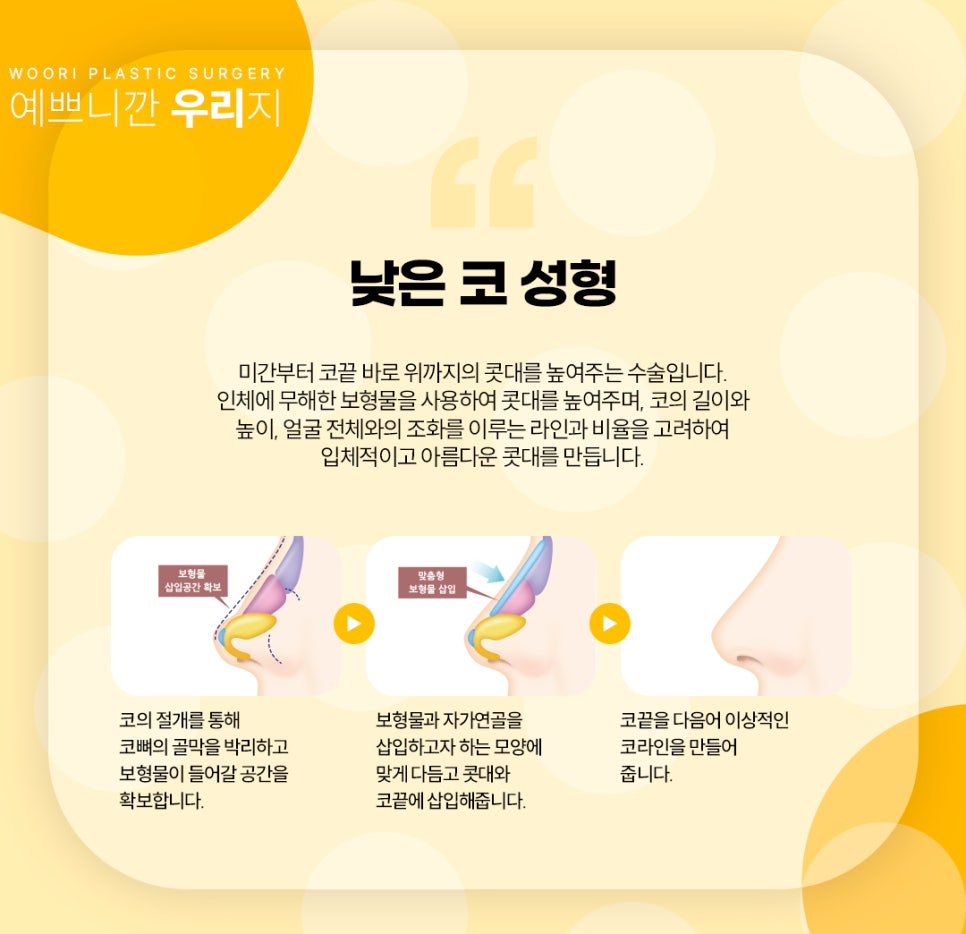 코성형 보험 가능한지 여부는? 코성형 부작용과 회복 관련 이미지 5