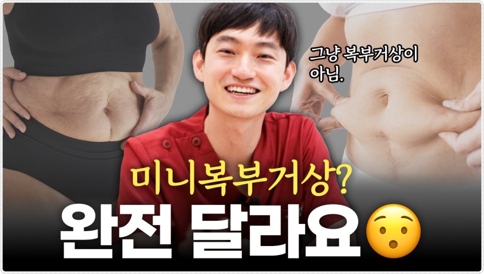 복부거상술 상담 전 체크 사항 관련 이미지 1