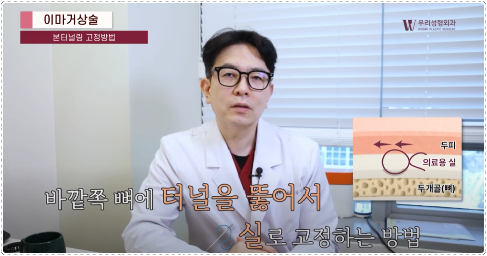 20대 이마거상술 어떤 재료를 사용해야할까? 관련 이미지 3