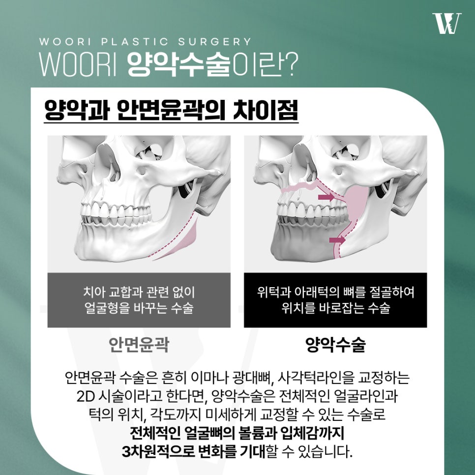 How Can the Facial Shape Change After Double Jaw Surgery? image 2