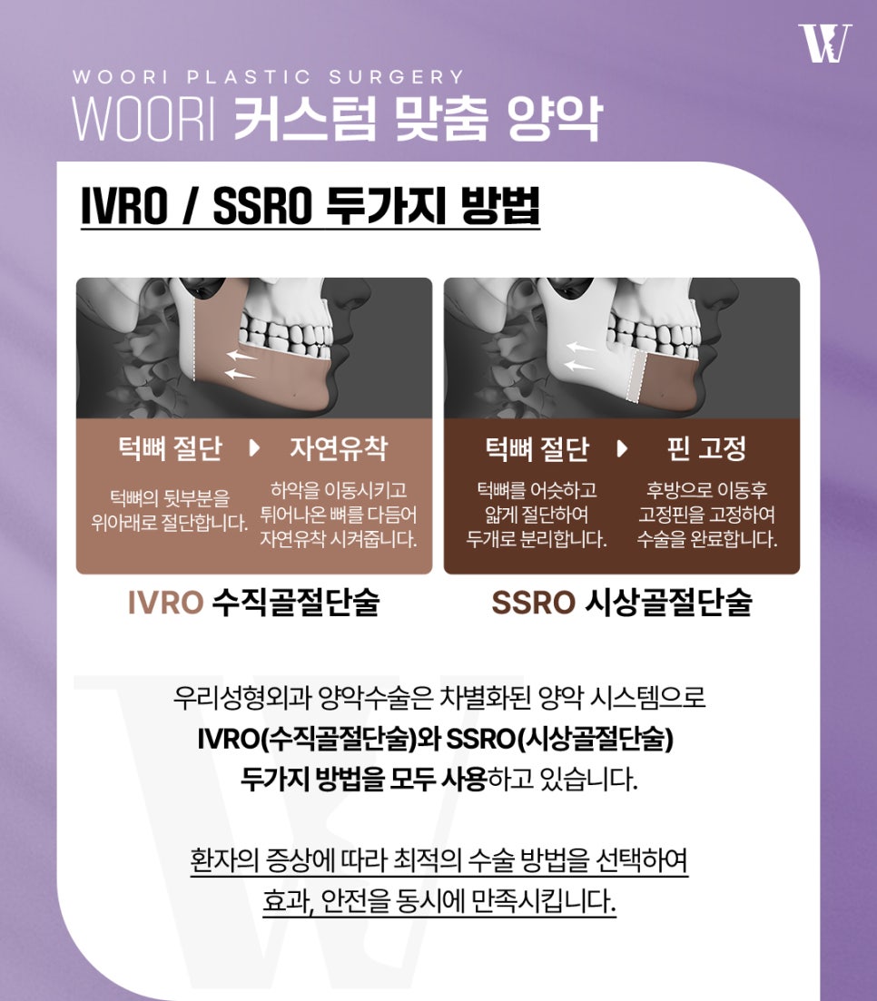 양악수술후기 외모보다 기능 변화가 만족스러운 이유 관련 이미지 3