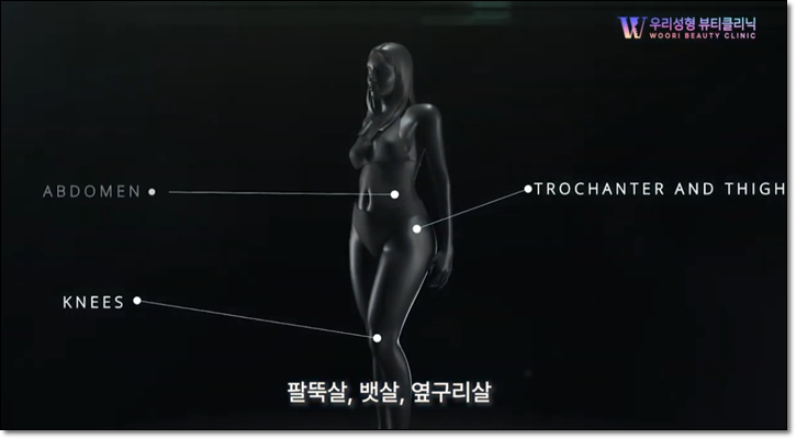 온다 바디 리프팅 효과 있을까? 관련 이미지 4