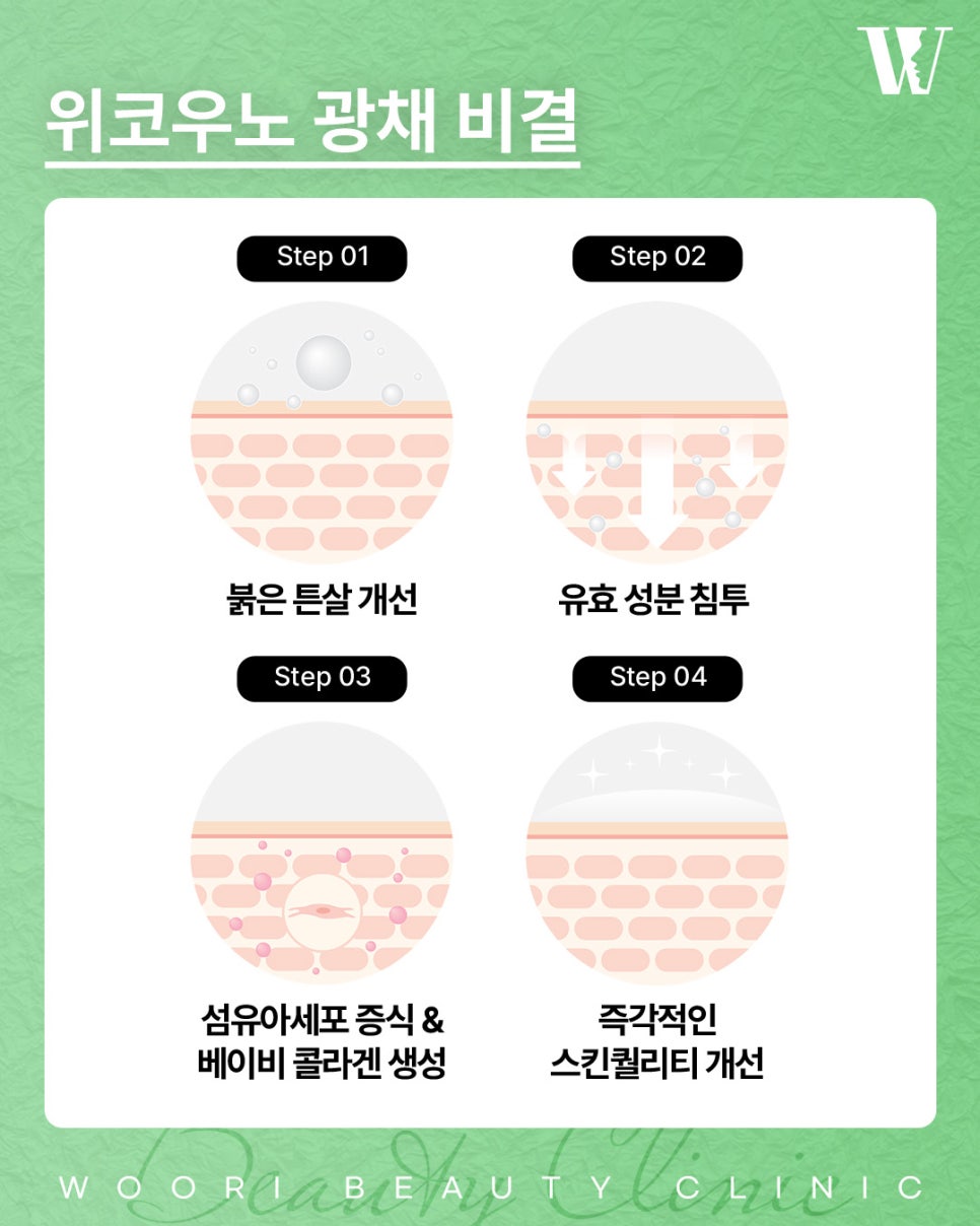 위코우노 모공과 잔주름을 함께 관리할 수 있을까요? 관련 이미지 5