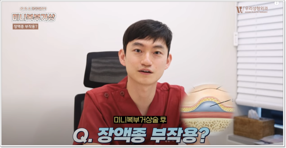 복부거상술 흉터 고민이 된다면 관련 이미지 5