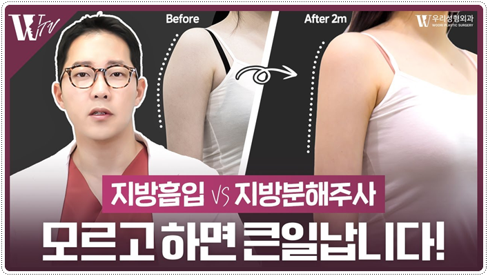 지방분해주사효과 어떤가요? 관련 이미지 1