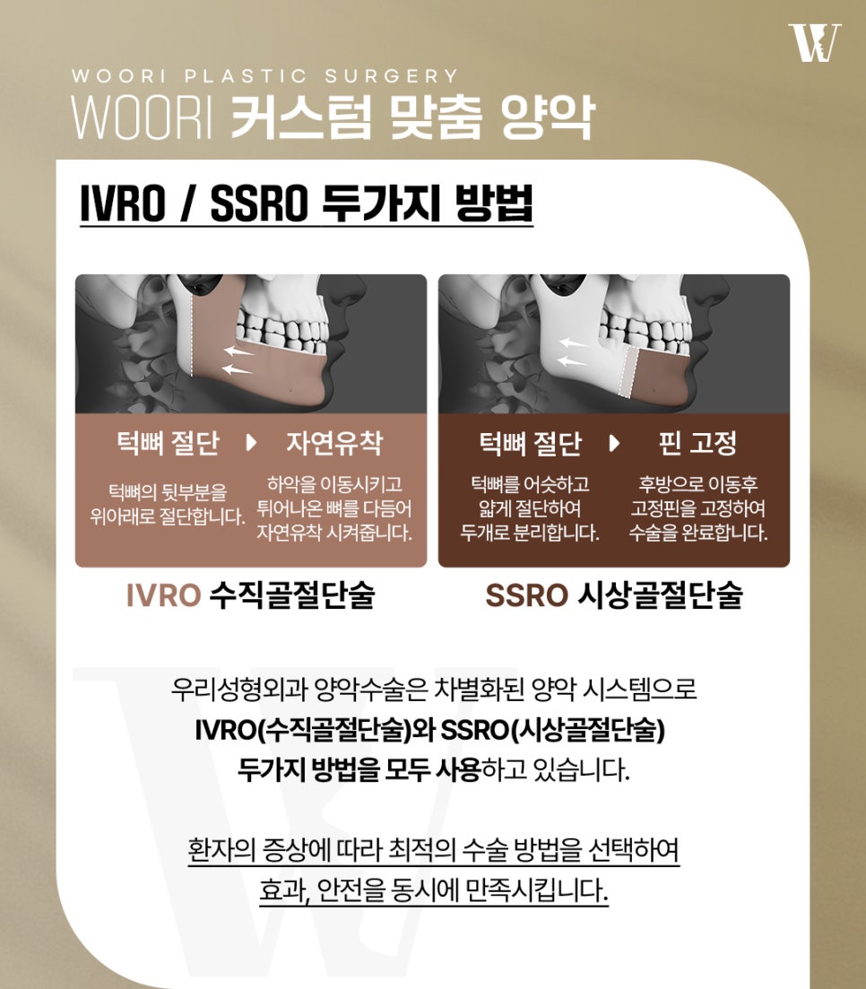 양악수술 안면윤곽수술과의 차이점과 수술 방법 관련 이미지 3