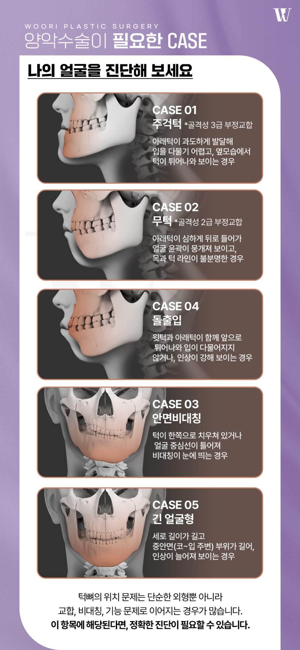 양악수술후기 외모보다 기능 변화가 만족스러운 이유 관련 이미지 4