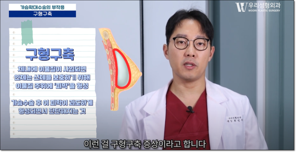 가슴확대수술 부작용 발생 원인은? 관련 이미지 2