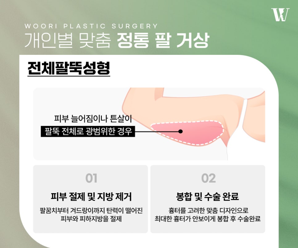 팔거상 늘어진 팔뚝살에 필요한 이유 관련 이미지 5