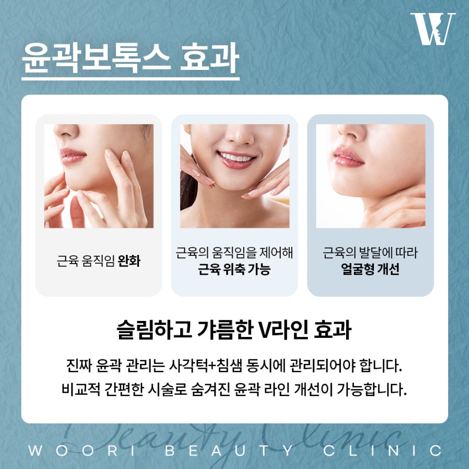 Why Combine Square Jaw Botox with Salivary Gland Botox? image 3