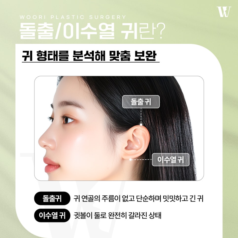 The Impact of Ear Shape on Facial Impression: Otoplasty image 2