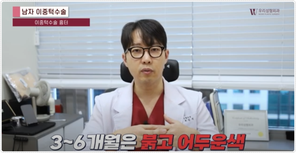 이중턱살 확실히 없애는 방법 관련 이미지 4