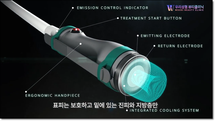 온다 바디 리프팅 효과 있을까? 관련 이미지 2