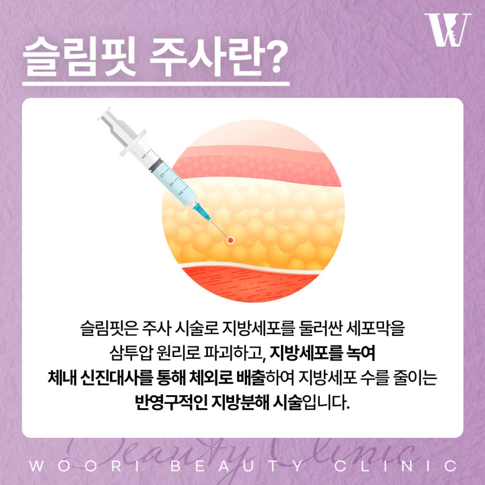 Where Does Facial Fat Accumulate? Facial Fat-Dissolving Injections image 3