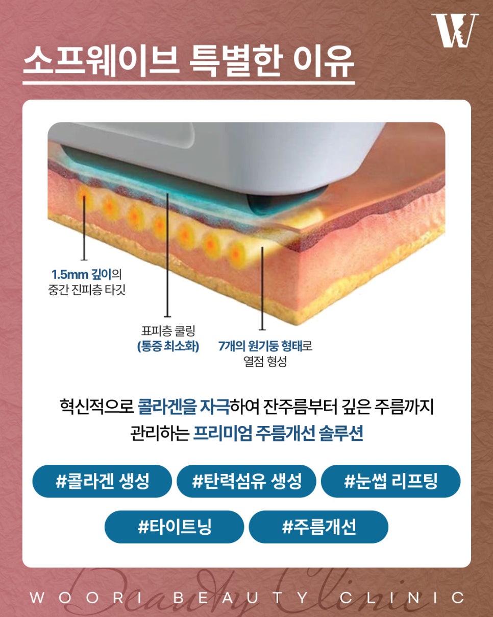 소프웨이브가격 추천하는 유형 알아보자 관련 이미지 3