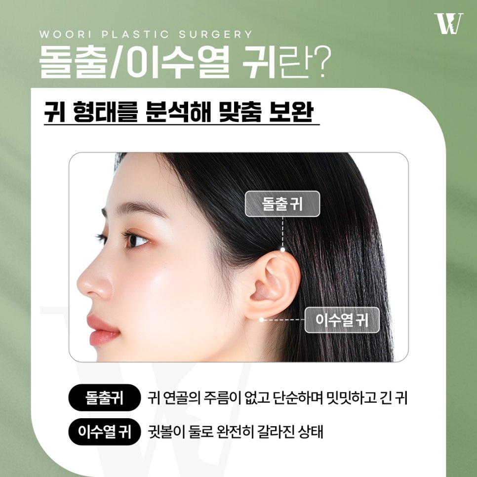 이수열수술 귓볼이 찢어졌을 때 필요해요 관련 이미지 2