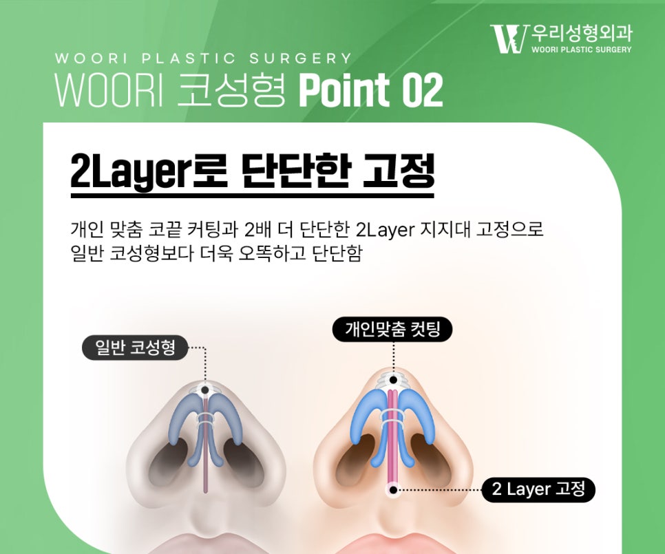 What to Check When Considering Male Rhinoplasty image 4