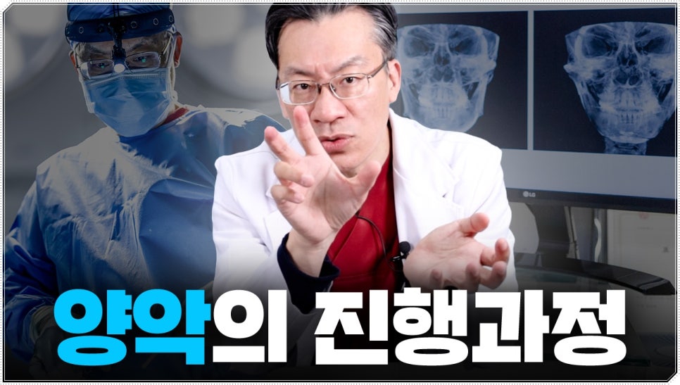 양악수술방법 이렇게 진행돼요 관련 이미지 1