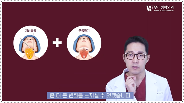 이중턱살 빼는법 어떻게 해결해야할까 관련 이미지 4