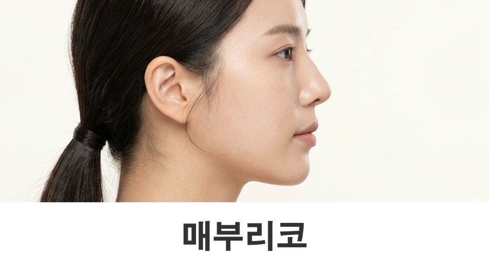 매부리코 수술 매부리만 없애는 것보다 중요한 것은? 관련 이미지 1