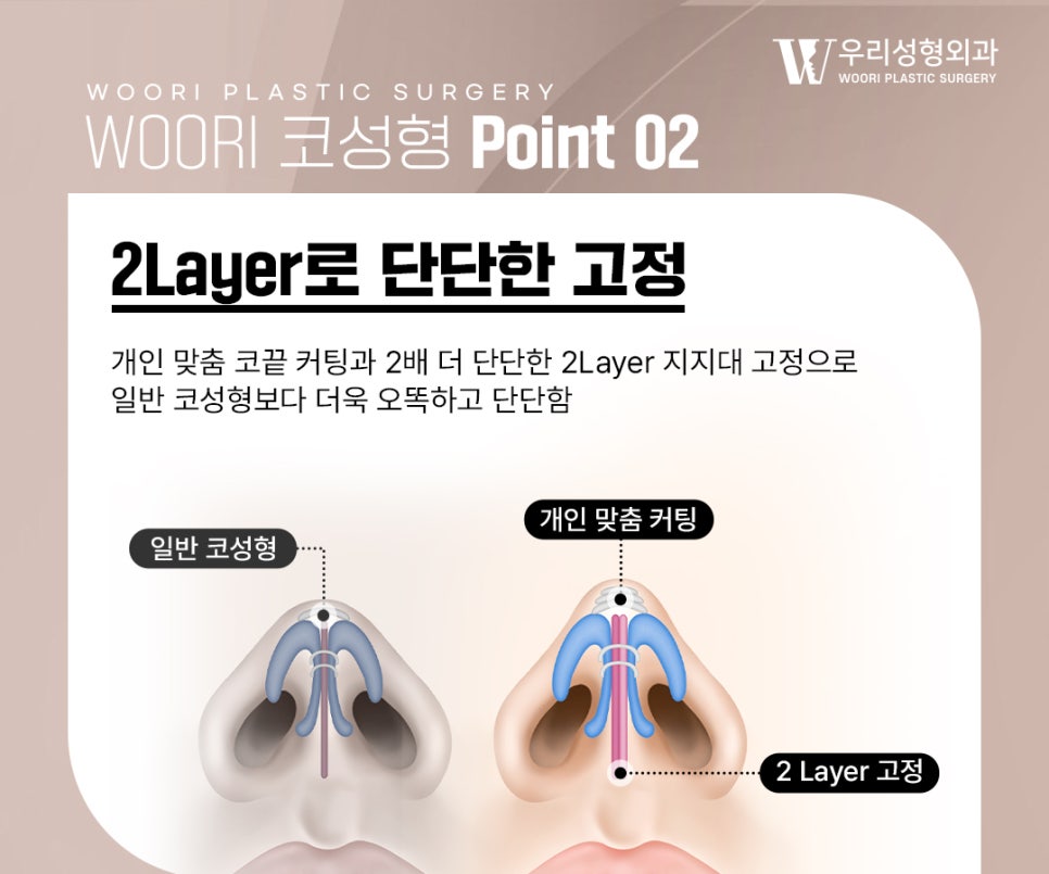 코성형 코끝의 안정감까지 생각합니다 관련 이미지 4