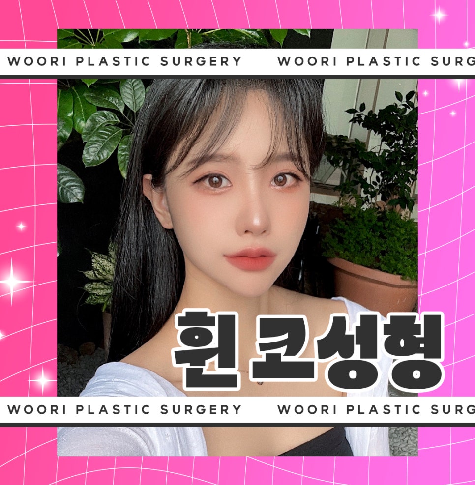 휜 코성형 방법과 코 수술 비용, 가격 궁금하다면 관련 이미지 2