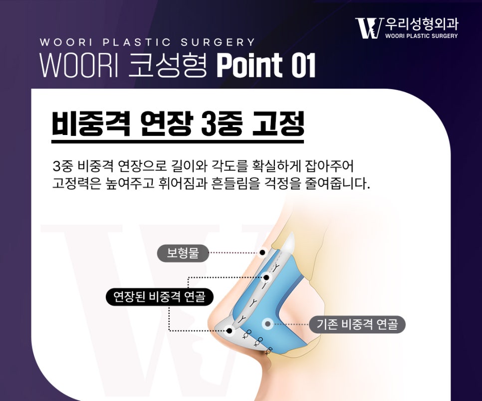 코성형, 비율과 구조를 함께 보는 이유 관련 이미지 2