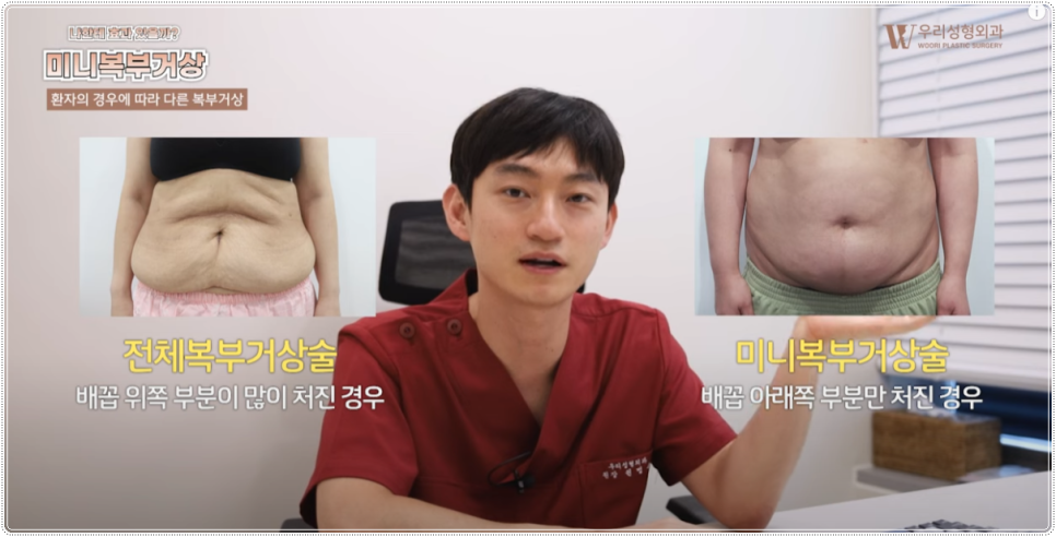 복부거상 재수술 피하려면? 관련 이미지 2