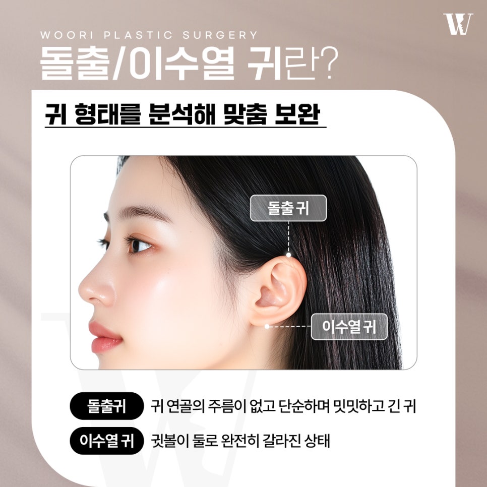돌출귀수술 한쪽 귀만 튀어나온 경우에도 교정할 수 있을까요? 관련 이미지 2