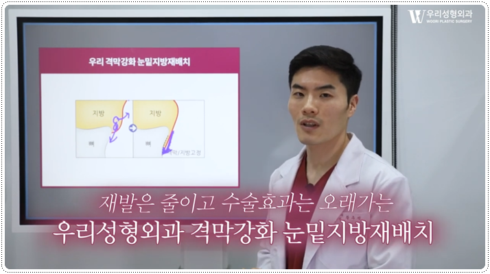 눈밑지방재배치 격막강화술이란 무엇일까 관련 이미지 5