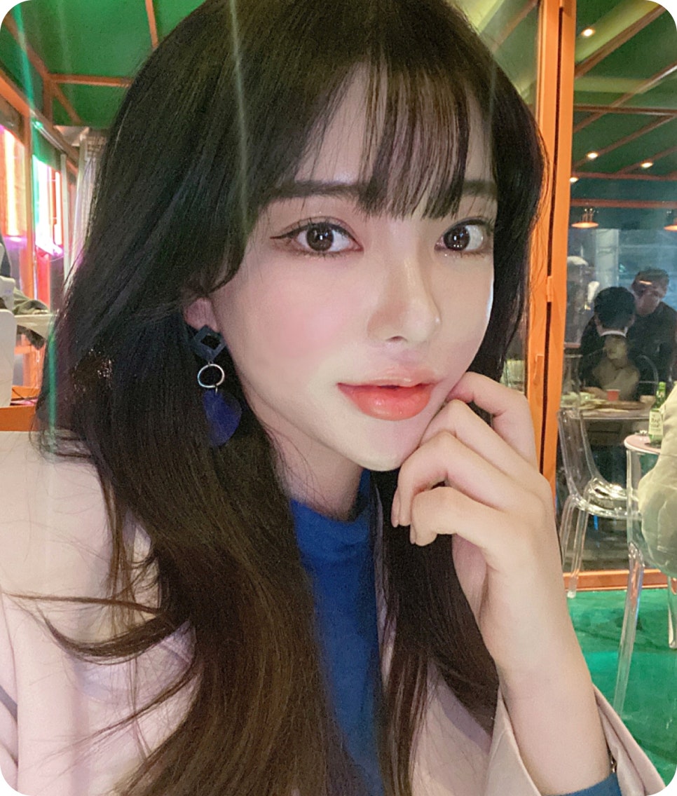 안면윤곽 3종 얼굴형에 큰 변화를 관련 이미지 14