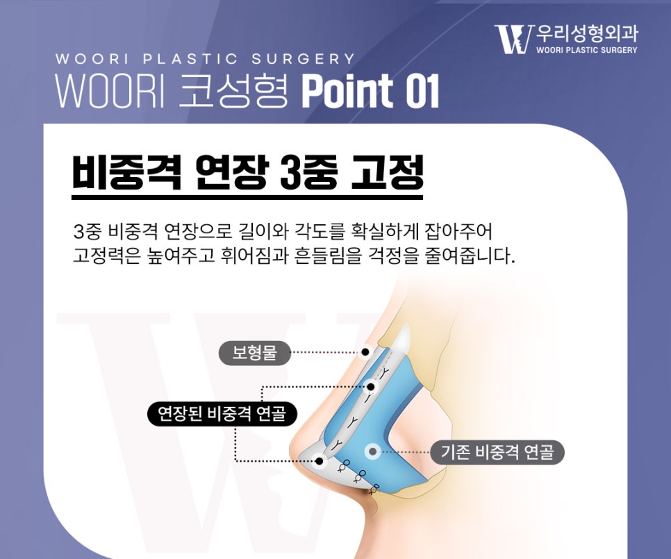 복코성형 코끝이 뭉툭해 보이는 이유는? 관련 이미지 3