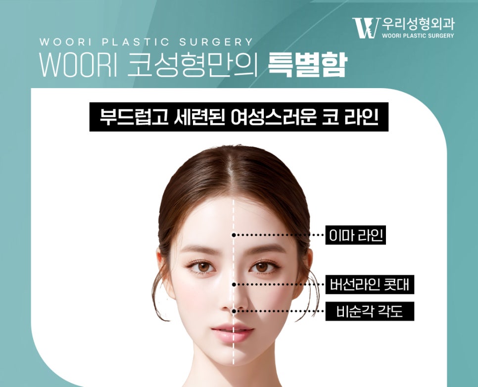 매부리코 수술 매부리만 없애는 것보다 중요한 것은? 관련 이미지 2