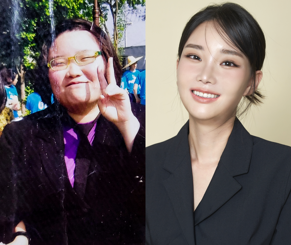 우리성형외과 X 맥미걸 메이크오버 프로젝트 첫 방영 관련 이미지 12