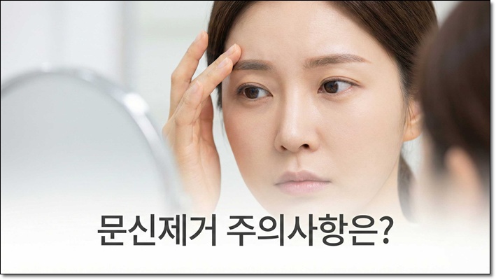 문신제거 시술 시 주의사항 알아보기 관련 이미지 1