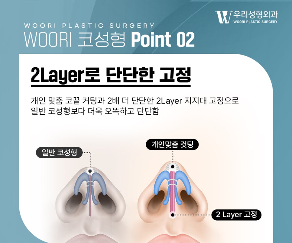 복코 개선 인상이 달라보이는 이유 관련 이미지 4