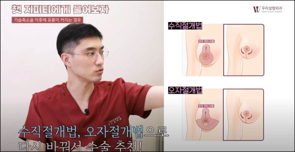 가슴축소병원 선택 전 꼭 알아야할 수술법 관련 이미지 5