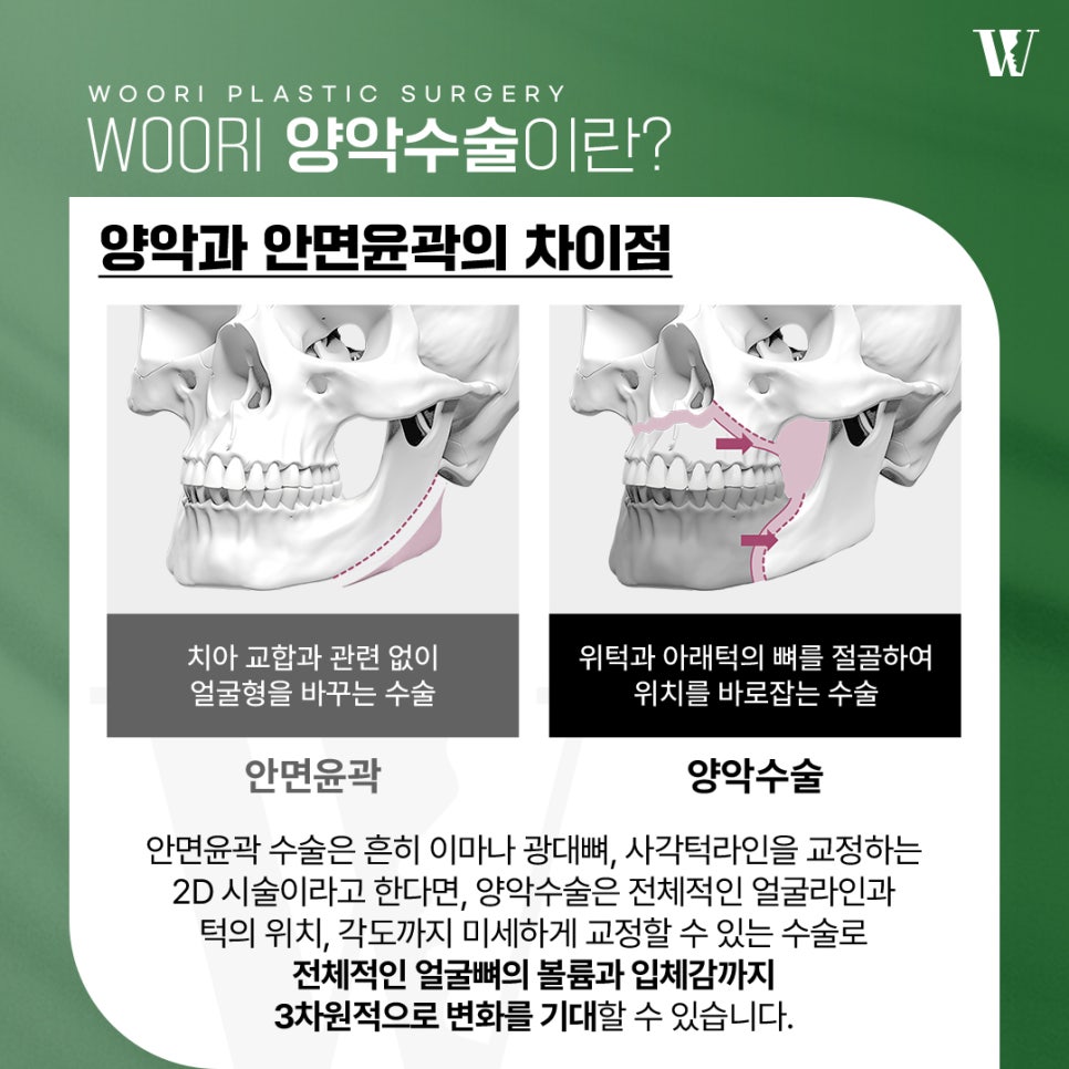 양악수술 필요한 케이스 알아보자 관련 이미지 2