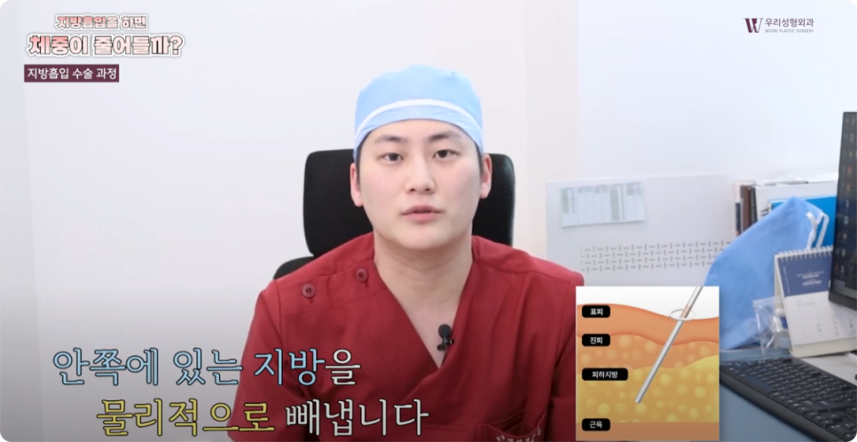 전신지방흡입 시 몸무게 변화가 생길까요? 관련 이미지 4