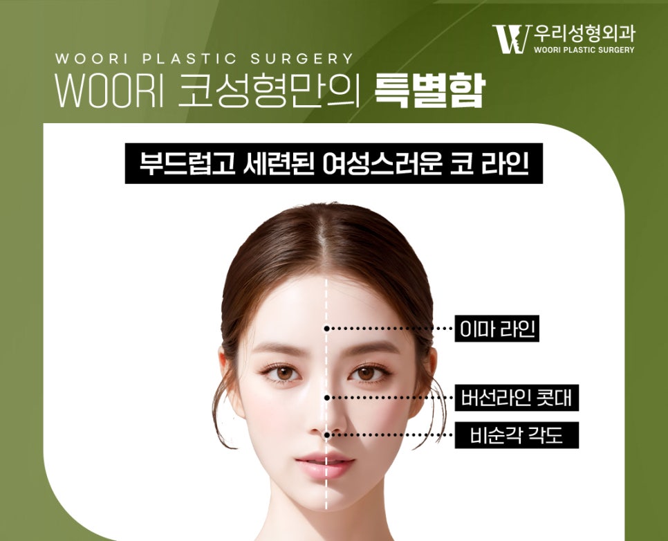 코성형 전 체크해 보세요! 관련 이미지 2
