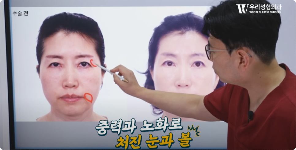 이마거상 비용 사용해야될까 관련 이미지 4