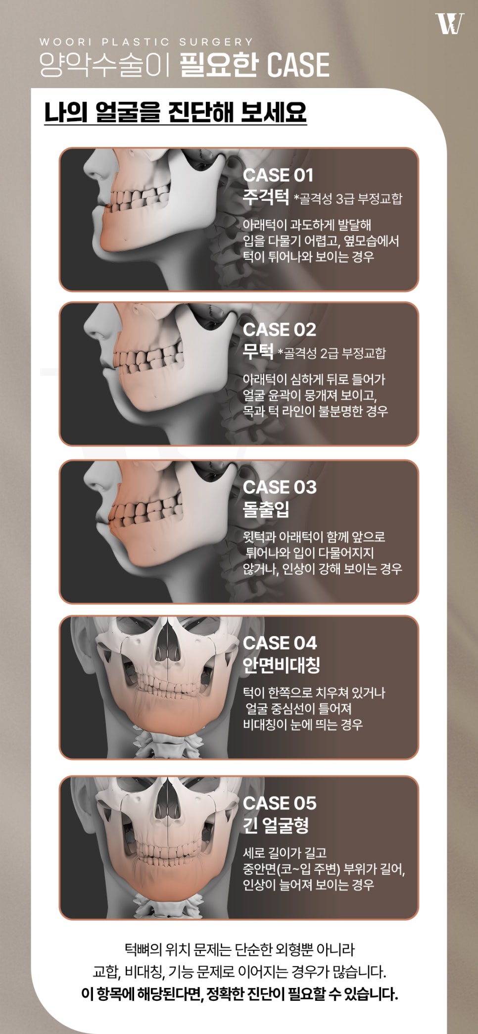양악수술 얼굴 균형과 기능을 함께 고려하는 이유 관련 이미지 3