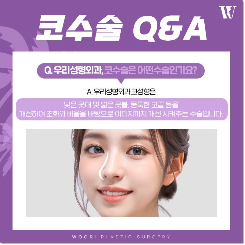 남자 코성형 가격 기능코 차이 관련 이미지 4