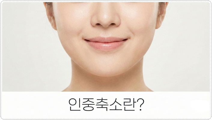 인중축소술 이후 변화는? 관련 이미지 1