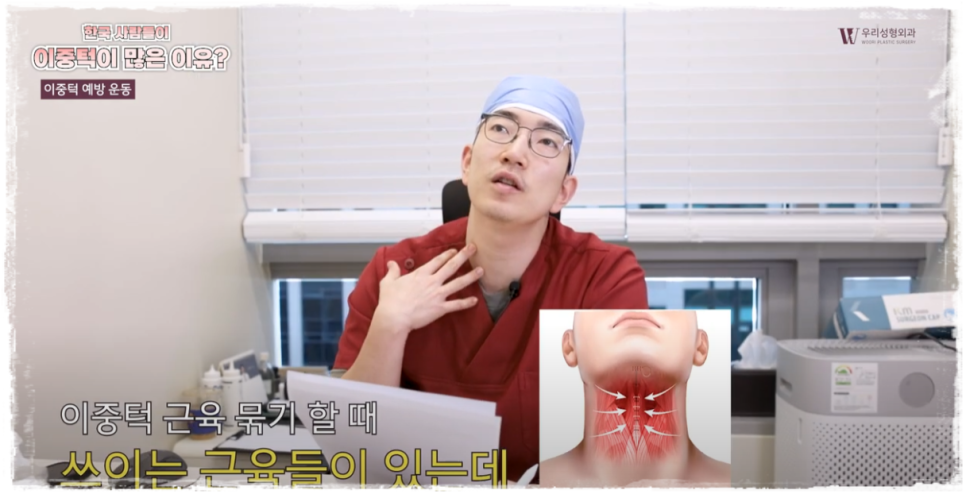 이중턱살제거 및 발생 원인 알아봐요 관련 이미지 7