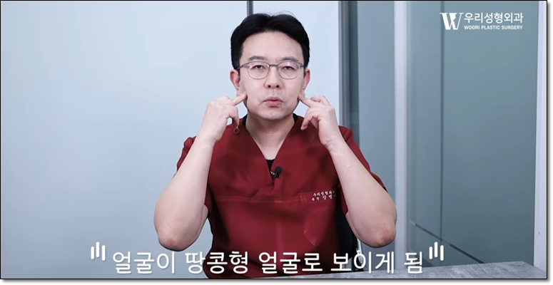 심부볼 제거 안면거상이 필요한 이유 관련 이미지 4