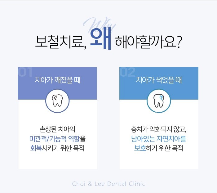 레진치료가격 무엇을 중점으로 관련 이미지 4